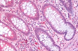 Invitrogen SLC5A4 Polyclonal Antibody 50 &mu;g; Unconjugated:Antibodies,
