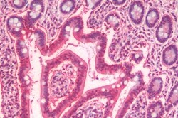 Invitrogen SLC5A4 Polyclonal Antibody 50 &mu;g; Unconjugated:Antibodies,