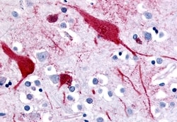 Invitrogen SLC5A9 Polyclonal Antibody 50 &mu;g; Unconjugated:Antibodies,