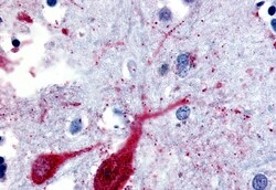SLC5A9 Polyclonal Antibody:Antibodies, Polyclonal