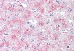 SLITRK6 Polyclonal Antibody:Antibodies, Polyclonal