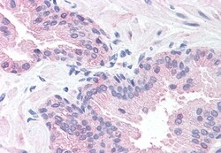 SLITRK6 Polyclonal Antibody:Antibodies, Polyclonal