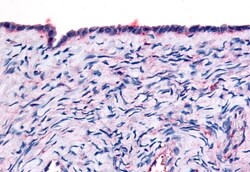 Invitrogen THRA Polyclonal Antibody 50 μg; Unconjugated:Antibodies,