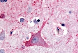 Invitrogen TRHR Polyclonal Antibody 50 &mu;g | Buy Online | Invitrogen&trade; | Fisher Scientific