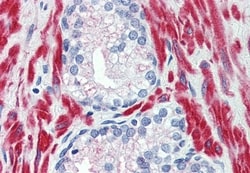 Invitrogen TRPM8 Polyclonal Antibody 50 &mu;g; Unconjugated:Antibodies,