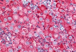 Invitrogen TRPV2 Polyclonal Antibody 50 &mu;g | Buy Online | Invitrogen&trade; | Fisher Scientific