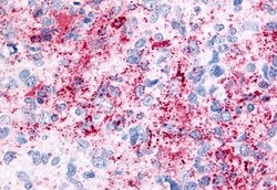 Invitrogen TRPV2 Polyclonal Antibody 50 &mu;g | Buy Online | Invitrogen&trade; | Fisher Scientific