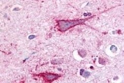 Invitrogen TRPV2 Polyclonal Antibody 50 &mu;g | Buy Online | Invitrogen&trade; | Fisher Scientific