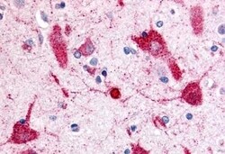 Invitrogen TRPV2 Polyclonal Antibody 50 &mu;g | Buy Online | Invitrogen&trade; | Fisher Scientific