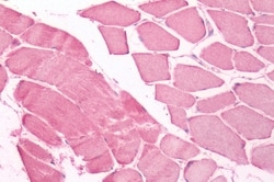 Invitrogen UCHL3 Polyclonal Antibody 50 &mu;g; Unconjugated:Antibodies,