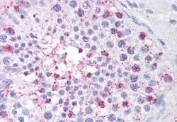 USP2 Polyclonal Antibody:Antibodies, Polyclonal