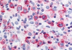 Invitrogen USP20 Polyclonal Antibody 50 &mu;g; Unconjugated:Antibodies,