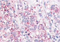 Invitrogen USP20 Polyclonal Antibody 50 &mu;g; Unconjugated:Antibodies,