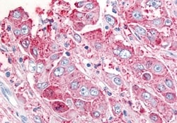 Invitrogen USP20 Polyclonal Antibody 50 &mu;g; Unconjugated:Antibodies,