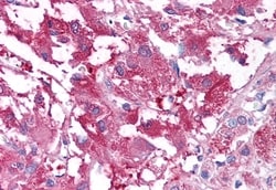 Invitrogen USP20 Polyclonal Antibody 50 &mu;g; Unconjugated:Antibodies,