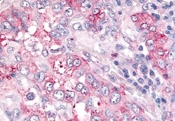 Invitrogen USP4 Polyclonal Antibody 50 &mu;g | Buy Online | Invitrogen&trade; | Fisher Scientific