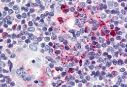 Invitrogen USP4 Polyclonal Antibody 50 &mu;g | Buy Online | Invitrogen&trade; | Fisher Scientific