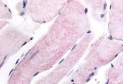 Invitrogen WNK1 Polyclonal Antibody 50 μg; Unconjugated:Antibodies,