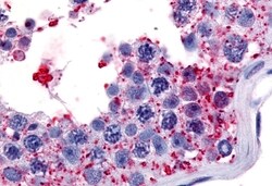 Invitrogen WNK1 Polyclonal Antibody 50 &mu;g; Unconjugated:Antibodies,