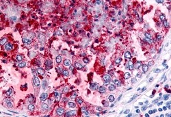 Invitrogen WNK1 Polyclonal Antibody 50 &mu;g; Unconjugated:Antibodies,