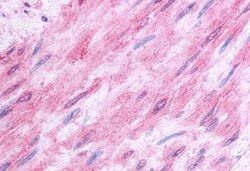 Invitrogen HTR1B Polyclonal Antibody 50 &mu;g; Unconjugated:Antibodies,