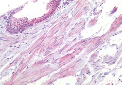 Invitrogen HTR1B Polyclonal Antibody 50 &mu;g; Unconjugated:Antibodies,