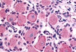 HTR1D Polyclonal Antibody:Antibodies, Polyclonal