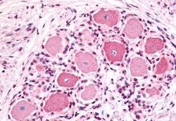 Invitrogen HTR1D Polyclonal Antibody 50 &mu;g | Buy Online | Invitrogen&trade; | Fisher Scientific