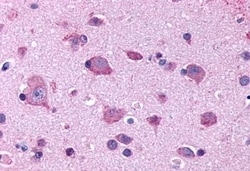 HTR2B Polyclonal Antibody:Antibodies, Polyclonal