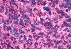 HTR2B Polyclonal Antibody:Antibodies, Polyclonal