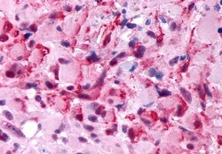 HTR2B Polyclonal Antibody:Antibodies, Polyclonal