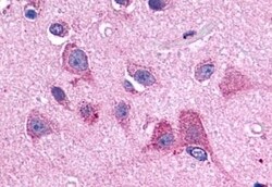 HTR2B Polyclonal Antibody:Antibodies, Polyclonal