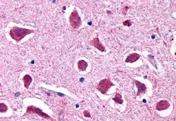 HTR2B Polyclonal Antibody:Antibodies, Polyclonal