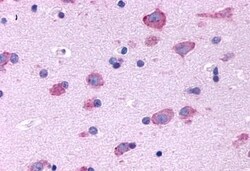Invitrogen&trade;&nbsp;HTR2B Polyclonal Antibody