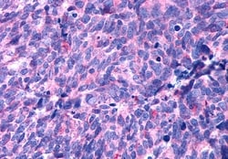 Invitrogen&trade;&nbsp;HTR2B Polyclonal Antibody