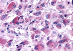 Invitrogen™ HTR2B Polyclonal Antibody