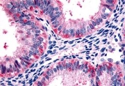 Invitrogen HTR2C Polyclonal Antibody 50 &mu;g; Unconjugated:Antibodies,