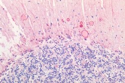 HTR2C Polyclonal Antibody:Antibodies, Polyclonal