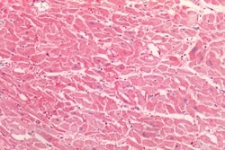 HTR2C Polyclonal Antibody:Antibodies, Polyclonal
