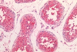 HTR2C Polyclonal Antibody:Antibodies, Polyclonal