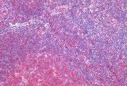 HTR2C Polyclonal Antibody:Antibodies, Polyclonal