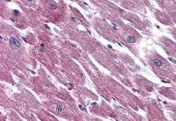 Invitrogen PACAP Receptor Polyclonal Antibody 50 &mu;g; Unconjugated:Antibodies,