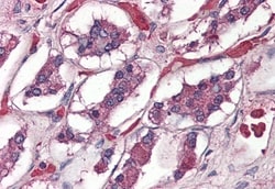 Invitrogen PACAP Receptor Polyclonal Antibody 50 &mu;g; Unconjugated:Antibodies,
