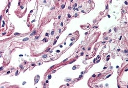 Invitrogen ADORA2A Polyclonal Antibody 50 μg; Unconjugated:Antibodies,