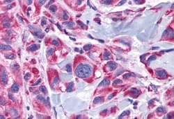 alpha-1d Adrenoceptor Polyclonal Antibody:Antibodies, Polyclonal