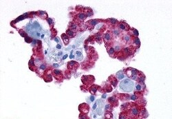 alpha-1d Adrenoceptor Polyclonal Antibody:Antibodies, Polyclonal
