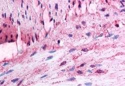 Invitrogen alpha-1d Adrenoceptor Polyclonal Antibody 50 &mu;g; Unconjugated:Antibodies,