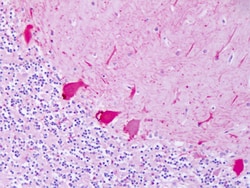 Invitrogen beta-2 Adrenergic Receptor Polyclonal Antibody 50 μg; Unconjugated:Antibodies,