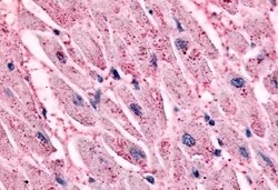 Invitrogen beta-2 Adrenergic Receptor Polyclonal Antibody 50 μg; Unconjugated:Antibodies,