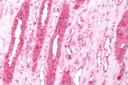 beta-3 Adrenergic Receptor Polyclonal Antibody:Antibodies, Polyclonal